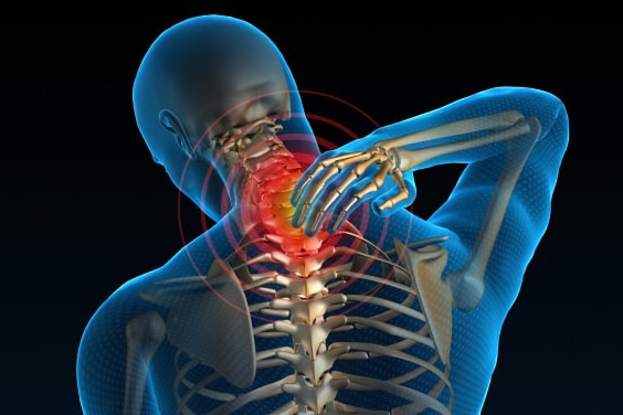 Neck Pain