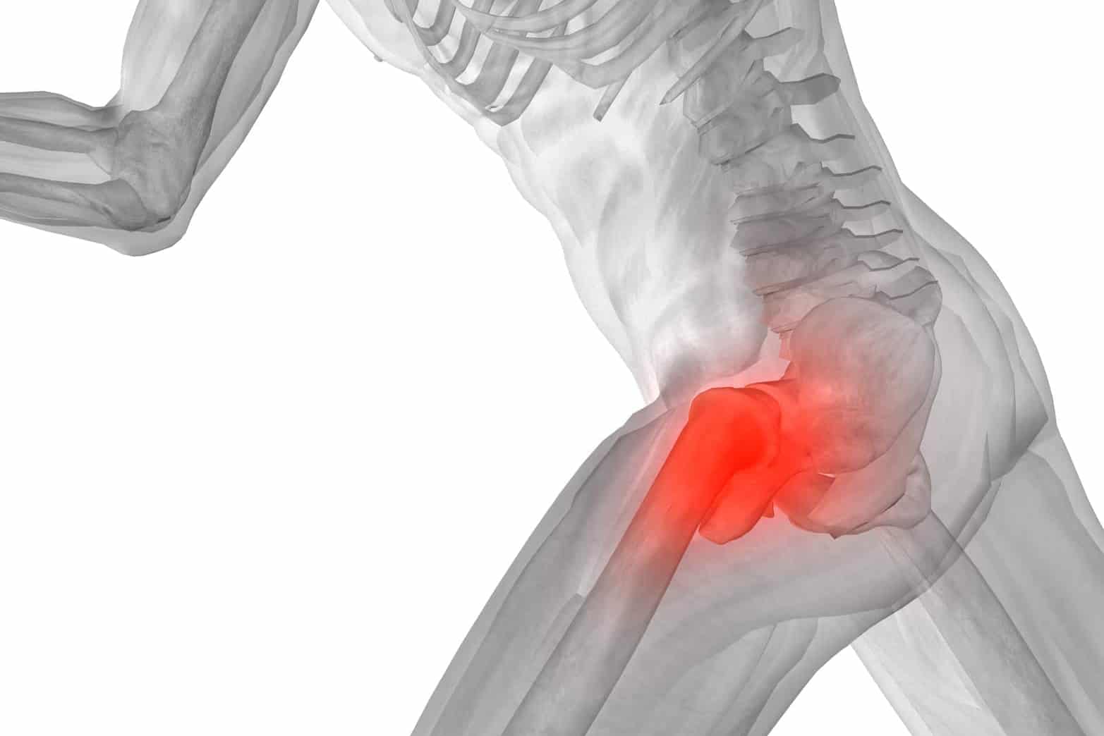 Hip Pain – Chiropractic Versus Pain Killers