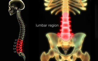 Fort Myers and Naples Lower Back Pain