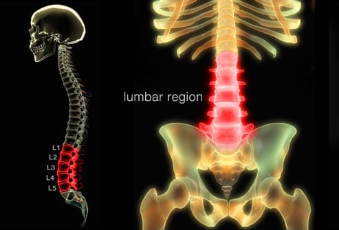 3d4m_rm_illustration_of_lumbar_spine.jpg